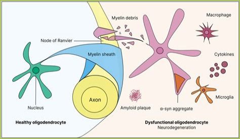 Neville Archambault's Passing: Unraveling the Cause of Death